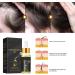 Tress Diary Hair Growth Oil for Black Women and Men Essential Oil for Hair Growth - Buy Online on GoSupps.com