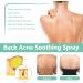 Back Acne Treatment Spray Acne Body Spray Adolescent Acne Treatment Body Moisturiser For Dry Skin Acne Moisturiser Repair Back Shoulder Acne & Body Acne & Chest Acne - Buy Online on GoSupps.com
