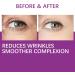 Vitamin C + Retinol Eye Cream Eye Cream for Dark Circles and Bags Under Eyes Anti Aging Eye Cream Collagen Eye Cream Reduces Fine Lines Wrinkles - Buy Online on GoSupps.com