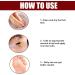 RZAJJN GFOUK Foot Corn Removal Extra Strength Gel 10ml - 2pcs - Buy Online on GoSupps.com