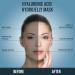 Hyaluronic Acid Jelly Mask - Professional Hydro Glo Peel-Off Mask for Hydration Soothing Skin & Glowing Skin Suitable for All Skin Types Vajafacial Jelly Mask | 12 Applications (30 Fl Oz) - Buy Online on GoSupps.com