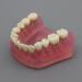 Dental Implant Teeth Model - Standard Study and Teaching Tool with Removable Teeth - Buy Online on GoSupps.com