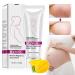 Fengyang stretch strips cream scar removal removal cream stretch strip repair cream pregnancy scars cream stretch marks cream 40g