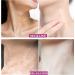 Mango Firming Neck Cream Anti Wrinkle Neck Cream Firming and Rejuvenating Neck Cream Best Anti Wrinkle Neck Cream for Deep Wrinkles Neck Cream - Buy Online on GoSupps.com
