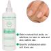 Cuticle Softener for Nails Manicure Removal Softening Nail Tool to Remove Dead Skin - Buy Online on GoSupps.com