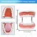 Immediate Freeward Model 6X - Expandable Speech Therapy Tool with Metal Hinge Removable Tongue & Teeth | PVC | International Shipping - Buy Online on GoSupps.com