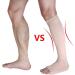 XXL Skin Color Toeless Compression Socks 23-32 mmHg | Medical Open Toe Stockings for Varicose Veins - Buy Online on GoSupps.com