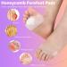12pc Ball of Foot Cushions Set - Reusable Metatarsal Pads for Women High Heels - Pain Relief & Comfort - Buy Online on GoSupps.com