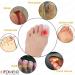 Pedimend Gel Toe & Finger Cap Protectors - Protection Pain Relief for Bunions Corns Calluses Orthotic Breathable Toe Caps Athletics Running For Men and Women 1 Pair - 4.45 - Buy Online on GoSupps.com