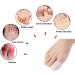 PEDIMEND Soft Silicone Big Toe Caps for Ingrown Nail Relief - Foot Pain Relief - Prevent Corns & Blisters - Men and Women - Foot Care (4 Pair/8pcs) - Buy Online on GoSupps.com