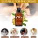 AllbestAye Lymphatic Drainage Ginger Essential Oil - Natural Massage Therapy for Relaxation & Stress Relief - Buy Online on GoSupps.com