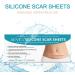 Silicone Scar Sheets for C-Section Surgery, Burn, Keloid, Acne - 4 Sheets (2 Month Supply) - Buy Online on GoSupps.com