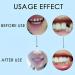 Regain Confidence with 2 Pairs of Smile Enhancers for Men & Women - Shop Internationally - Buy Online on GoSupps.com