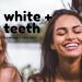 Sensitive Teeth Whitening Strips - Non Peroxide, Gentle Whitener Band Kit - 28 Pcs, 14 Treatments, 2 Week Supply - Buy Online on GoSupps.com