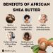 Kyabo Pure African White Ivory Shea Butter 5Lbs - Premium 100% Natural Virgin RAW Organic Grade A Unrefined from Ghana - Skin Beauty Care for Face, Body, Hair, and Scalp - Non GMO Natural Karite - Buy Online on GoSupps.com