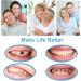Temporary Tooth Repair Kit with Fitting Beads & Fake Teeth - Ideal for Fixing Missing or Broken Teeth - Buy Online on GoSupps.com