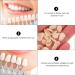 200pcs Dental Temporary Crown Veneers Kit - Tooth Repair Replacements - Beige - Buy Online on GoSupps.com