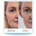PureHA Oral Hyaluronic Acid Supplements - 30 Days Supply for Youthful Skin - Buy Online on GoSupps.com