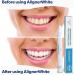 EverSmile AlignerWhite Teeth Whitening Pen for Clear Aligners & Retainers - Gel Whitener - Buy Online on GoSupps.com
