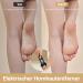 Electric Corn Removal Tool - 2 Replacement Rolls 2 Speeds for Extreme Foot Care - Black - Buy Online on GoSupps.com