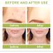 Tea Tree Ance Serum Tea Tree Essential Oils Tea Tree Oil For Skin Anti-Pimples and Acne Moisturizer and Brighten Skin.Tea Tree Oil for Diffuser Humidifier DIY Home Office 100ml - Buy Online on GoSupps.com