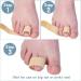 Toe Separators for Overlapping Toes & Bunions - Reusable Fabric Buddy Wraps for Big Toe Alignment & Hammertoe Correction - 4 Count (Beige - Buy Online on GoSupps.com