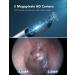 Ear Wax Removal Kit - Ear Cleaner Ear Camera - Ear Wax Remover with 6 Pcs Ear Set - Ear Wax Removal Tool - WiFi Otoscope Camera with 6 Silicon Ear Spoon - Ear Cleaning for iOS & Android (Black) - Buy Online on GoSupps.com
