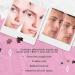 Buy Bye Bye Blemish Resurfacing AHA + BHA Peeling Serum 30 ml | Best International Shipping & Skincare Solution - Buy Online on GoSupps.com