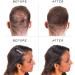 Nanogen Hair Fibres 15g Auburn - Pack of 1 | Instantly Conceal Thinning Hair - Buy Online on GoSupps.com