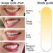 Teeth Whitening Strips for Sensitive Teeth Peroxide Free & Enamel Safe | 14 Professional Whitening Strips - Buy Online on GoSupps.com