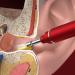 GIENEX Ear Wax Removal Tool with Camera & 6 LED Lights - Red Earwax Removal Kit for Kids, Adults, and Pets - Buy Online on GoSupps.com