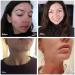 Science of Skin Rescue No. One - Ultimate Treatment for Spots Blemishes & Acne Scars | International Shipping Available - Buy Online on GoSupps.com