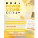 UGARDEN Power Vitamin C Serum with Snail Mucin - Hypoallergenic Skin Glow Ampoule - 1.01 fl.oz - Buy Online on GoSupps.com