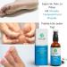 Green Idea Foot Spray | Mycofoot Spray with Manuka Tea Tree & Propolis | Athlete's Foot & Odor Relief | 50ml - Buy Online on GoSupps.com