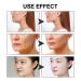Face Tape for Instant Facelift | Neck Tape & Face Lifting Solution for Jowls & Double Chin - International Shipping Available - Buy Online on GoSupps.com