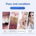 Amino Acid White Toothpaste | Enamel Care for Sensitive Teeth | Whitening & Deep Clean | Teeth Stain Removal Gel with 5% Hydroxyapatite | International Shipping Available - Buy Online on GoSupps.com