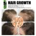 Mrinb Hair Growth Serum | Hair Treatment Oils for Thickening & Hair Loss | 10ml Hair Care Solution - Buy Online on GoSupps.com