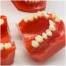Teeth Educational Model - Orthodontic Classification & Lesson Model for Dental Training | International Shipping Available - Buy Online on GoSupps.com