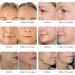 High-Tech RF Beauty Instrument - Skin Tightening Device for Face and body | home RF lifing | Salon effects | Collagen Stimulation for Wrinkle Reduction Facial Lifting - Buy Online on GoSupps.com