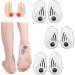 3 Pairs Silicone Heel Wedge Insoles for Foot Alignment & Pain Relief - Orthopedic Inserts with Magnet for Knock Knee & Bow Legs (M - Buy Online on GoSupps.com