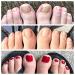 Fungal Nail Eraser Toenail Treatment - Maximum Strength Antifungal Relief for Clear, Healthy Nails - Effective Against Infections - Repair Brittle Nails - Buy Online on GoSupps.com