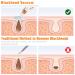 2023 Blackhead Remover Pore Vacuum - Upgraded Electric Facial Cleaner for Acne, Whiteheads - 5 Suction Power, 5 Probes - USB Rechargeable Kit for Women & Men - Buy Online on GoSupps.com