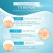 Anshka Organic scar removal gel natural scar therapeutic gel scar removal cream for old scars scar repair gel cream for men and women 1 piece - Buy Online on GoSupps.com