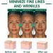 Skin Firming Rejuvenating Serum Skin Firming Serum Skin Firming Serum Refreshing and Non-Sticky Serum Serum for All Skin Types - Buy Online on GoSupps.com