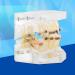 Dental Orthodontic Treatment Model - PVC Frame & Resin Teeth Transparent Gingiva | Small Size for Orthodontist Lessons in Oral Hygiene - Buy Online on GoSupps.com