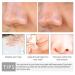 Symeas Retractable Pore Serum - Blackhead Reducer & Moisture Serum for Clean Skin | Anti-Pore Cleanser for Black Spots - International Shipping - Buy Online on GoSupps.com