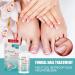 Mify 10ml Nail Fungus Treatment | Nail & Toenail Care Liquid | Fast-Acting Foot Care Solution - Buy Online on GoSupps.com