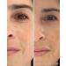 Then I Met You Ros Resurfacing Facial Mask - Nourishing AHA BHA Treatment | Vegan Brightening Skincare - Buy Online on GoSupps.com