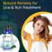 Lice Treatment Natural Remedy BM256 - Anti-Lice Supplement for Lice Removal & Itch Relief - Buy Online on GoSupps.com