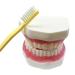 Youya 6-Fold Dental Brushing Teaching Model - Tooth Decay Evolution Display for Educational Use - Buy Online on GoSupps.com